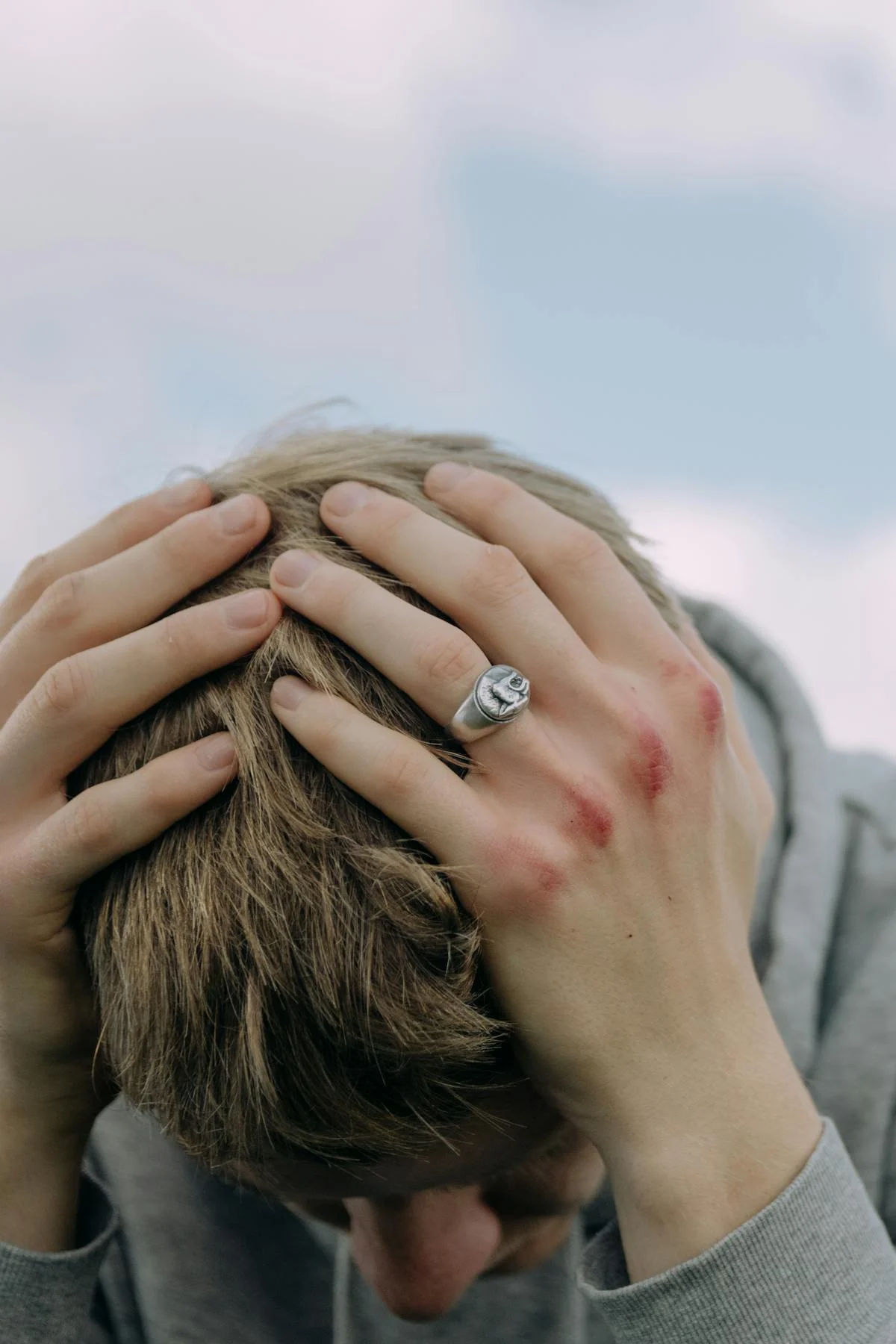 Headaches After a Car Accident? Here’s What You Need to Know
